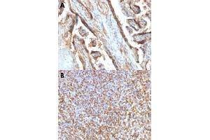Immunohistochemical staining (Formalin-fixed paraffin-embedded sections) of human placenta (A) and human spleen (B) with LGALS13 monoclonal antibody, clone PP13/1161 . (LGALS13 antibody  (AA 23-134))