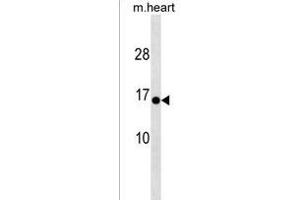 HIGD1C Antibody (C-term) (ABIN1537552 and ABIN2838282) western blot analysis in mouse heart tissue lysates (35 μg/lane). (HIGD1C antibody  (C-Term))