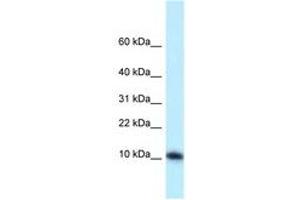 Image no. 1 for anti-Mediator Complex Subunit 21 (MED21) (AA 19-68) antibody (ABIN6747864) (MED21 antibody  (AA 19-68))