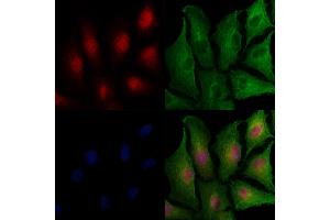 ABIN7093620 and ABIN7097645 staining  cells by IF/ICC. (WEE1 antibody)
