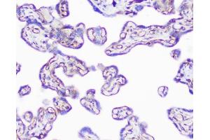 IHC analysis of INPPL1 using anti-INPPL1 antibody (ABIN6719492). (INPPL1 antibody  (AA 1172-1258))