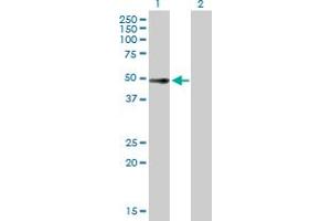 Western Blot analysis of ZCCHC6 expression in transfected 293T cell line by ZCCHC6 MaxPab polyclonal antibody. (ZCCHC6 antibody  (AA 1-412))