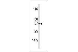 Western blot analysis of anti-Bik Pab (ABIN389524 and ABIN2839573) in mouse liver tissue lysate (35 μg/lane).