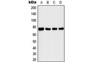 Western blot analysis of IRAK1 (pT209) expression in MCF7 IL1b-treated (A), K562 (B), MCF7 (C), Raw264. (IRAK1 antibody  (pSer209))