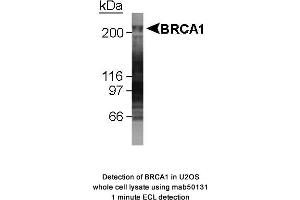 Image no. 1 for anti-Breast Cancer 1 (BRCA1) (AA 1314-1600), (AA 1314-1864) antibody (ABIN363285) (BRCA1 antibody  (AA 1314-1600, AA 1314-1864))