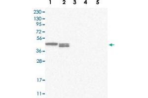 Western blot analysis of Lane 1: RT-4, Lane 2: U-251 MG, Lane 3: Human Plasma, Lane 4: Liver, Lane 5: Tonsil with TXNDC13 polyclonal antibody . (TMX4 antibody)
