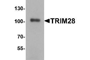 Western Blotting (WB) image for anti-Tripartite Motif Containing 28 (TRIM28) (C-Term) antibody (ABIN1077358) (KAP1 antibody  (C-Term))