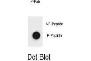 Dot blot analysis of Beclin 1 phospho antibody Phospho-specific Pab (ABIN658861 and ABIN2839835) on nitrocellulose membrane. (Beclin 1 antibody  (phosphorylated))