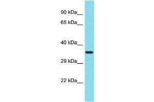 Host: Rabbit Target Name: SIAH3 Sample Type: MCF7 Whole Cell lysates Antibody Dilution: 1. (SIAH3 antibody  (C-Term))