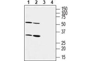 Western Blotting (WB) image for anti-Pyrimidinergic Receptor P2Y, G-Protein Coupled, 6 (P2RY6) (AA 172-186), (Extracellular) antibody (ABIN7043591)