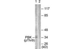 Western blot analysis of extracts from K562 cells treated with UV 30', using PBK/TOPK (Phospho-Thr9) Antibody.
