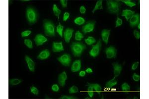 Immunofluorescence of monoclonal antibody to TUBB4B on HeLa cell. (TUBB2C antibody  (AA 1-445))
