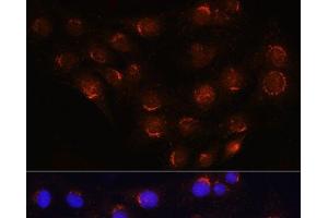 Immunofluorescence analysis of C6 cells using GOLGA4 Polyclonal Antibody at dilution of 1:100 (40x lens). (GOLGA4 antibody)