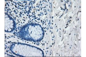 Image no. 1 for anti-Interferon Regulatory Factor 3 (IRF3) antibody (ABIN1498899) (IRF3 antibody)