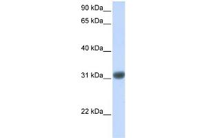 WB Suggested Anti-OTX2 Antibody Titration: 0. (OTX2 antibody  (Middle Region))