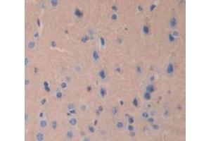 Immunohistochemistry (IHC) image for anti-Janus Kinase 2 (JAK2) (AA 120-367) antibody (ABIN1176454)