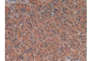 Detection of TUBd in Rat Stomach Tissue using Polyclonal Antibody to Tubulin Delta (TUBd) (TUBD1 antibody  (AA 238-482))