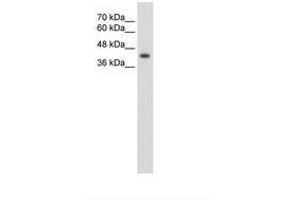 Image no. 3 for anti-GNAS Complex Locus (GNAS) (AA 51-100) antibody (ABIN203445) (GNAS antibody  (AA 51-100))