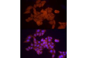 Immunofluorescence analysis of HeLa cells using PSM Rabbit pAb (752) at dilution of 1:50 (40x lens).