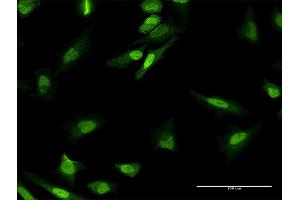 Immunofluorescence of purified MaxPab antibody to MPHOSPH8 on HeLa cell.