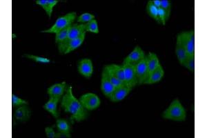 Immunofluorescence staining of HepG2 cells with ABIN7153555 at 1:166, counter-stained with DAPI. (SGCG antibody  (AA 108-221))