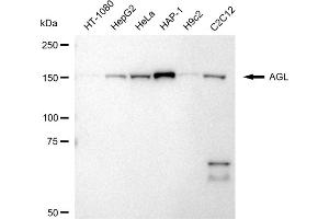 Western blotting analysis using AGL antibody (ABIN7797592).