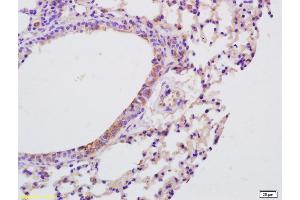 Formalin-fixed and paraffin embedded mouse lung labeled with Anti-IL-9 Polyclonal Antibody, Unconjugated (ABIN740130) at 1:200 followed by conjugation to the secondary antibody and DAB staining (IL-9 antibody  (AA 21-120))