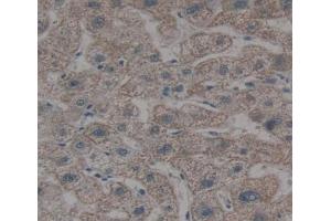 Used in DAB staining on fromalin fixed paraffin- embedded liver tissue (OSTM1 antibody  (AA 120-251))
