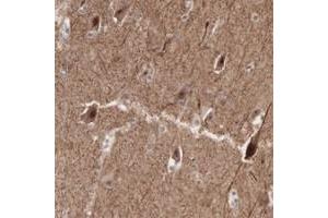 Immunohistochemical staining of human cerebral cortex with ACOT4 polyclonal antibody  shows strong cytoplasmic and nuclear positivity in neuronal cells.