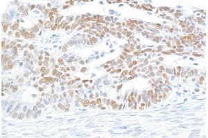 Immunohistochemistry (IHC) image for anti-Minichromosome Maintenance Complex Component 2 (MCM2) (AA 1-50) antibody (ABIN7453952)