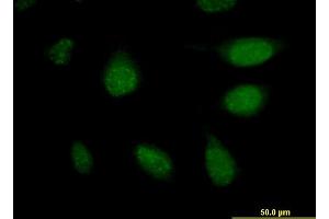 Immunofluorescence of monoclonal antibody to APCS on HeLa cell. (APCS antibody  (AA 35-149))