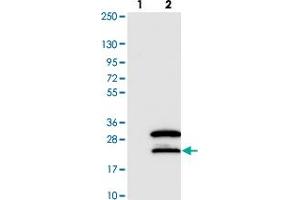 Western blot analysis of Lane 1: Negative control (vector only transfected HEK293T lysate). (SNRNP27 antibody)