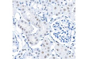 Immunohistochemistry (IHC) image for anti-BMI1 Polycomb Ring Finger Oncogene (BMI1) (AA 250-300) antibody (ABIN7455106) (Recombinant BMI1 antibody  (AA 250-300))