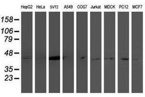 Image no. 2 for anti-NudE Nuclear Distribution E Homolog (A. Nidulans)-Like 1 (NDEL1) antibody (ABIN1499855) (NDEL1 antibody)