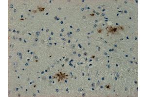 Immunostaining of paraffin embedded sections from mouse brain area containing Alzheimer plaques (dilution 1 : 1000). (SDCBP antibody)