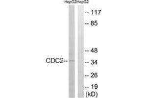 Western blot analysis of extracts from HepG2 cells, using CDC2 (Ab-161) Antibody. (CDK1 antibody  (AA 131-180))