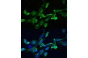 Immunofluorescence analysis of NIH-3T3 cells using SQS/FDFT1 antibody (ABIN6130393, ABIN6140567, ABIN6140568 and ABIN6221824) at dilution of 1:100. (FDFT1 antibody  (AA 1-260))