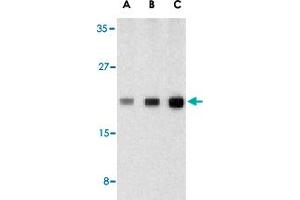 Western blot analysis of CASP1 in human heart tissue lysate with CASP1 polyclonal antibody  at (A) 0. (Caspase 1 antibody  (C-Term))