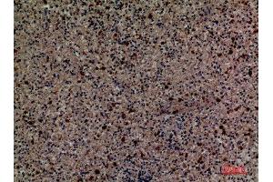 Immunohistochemistry (IHC) analysis of paraffin-embedded Human Spleen, antibody was diluted at 1:100. (CD58 antibody  (Internal Region))