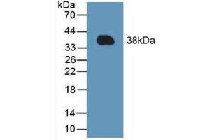Detection of Recombinant MCL1, Mouse using Polyclonal Antibody to Induced Myeloid Leukemia Cell Differentiation Protein Mcl-1 (MCL1) (MCL-1 antibody  (AA 2-307))