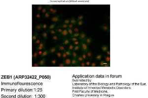 Image no. 2 for anti-Zinc Finger E-Box Binding Homeobox 1 (ZEB1) (N-Term) antibody (ABIN2779631) (ZEB1 antibody  (N-Term))
