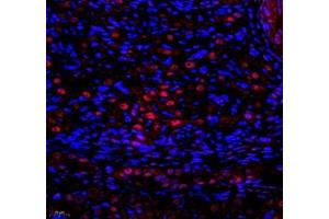 Immunofluorescence of paraffin embedded rat ovary using SNRNP200 (ABIN7075632) at dilution of 1: 650 (400x lens) (SNRNP200 antibody)