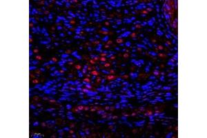 Immunofluorescence of paraffin embedded rat ovary using SNRNP200 (ABIN7075632) at dilution of 1: 650 (400x lens) (SNRNP200 antibody)