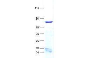 Validation with Western Blot