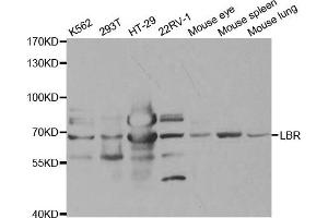 Western Blotting (WB) image for anti-Lamin B Receptor (LBR) antibody (ABIN1876656)
