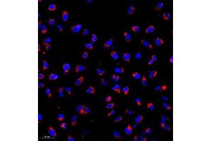Immunocytochemistry of paraffin embedded human HeLa cells using TOMO20 (ABIN7074636) at dilution of 1:1000 (200x lens)