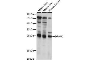 Western blot analysis of extracts of various cell lines, using DRAM1 antibody (ABIN6292483) at 1:1000 dilution. (DRAM antibody)