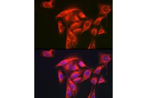 Immunofluorescence analysis of U-2 OS cells using GART Rabbit pAb (ABIN1679954, ABIN3018225, ABIN3018226 and ABIN6220407) at dilution of 1:200 (40x lens). (GART antibody  (AA 1-320))