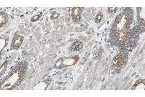 ABIN6277500 at 1/100 staining Human prostate tissue by IHC-P.