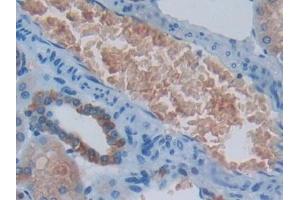 Immunohistochemistry (IHC) image for anti-Eukaryotic Translation Initiation Factor 2-alpha Kinase 2 (EIF2AK2) (AA 224-502) antibody (ABIN7431893)